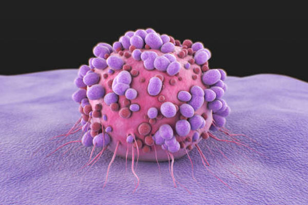 Soft Tissue Cancers