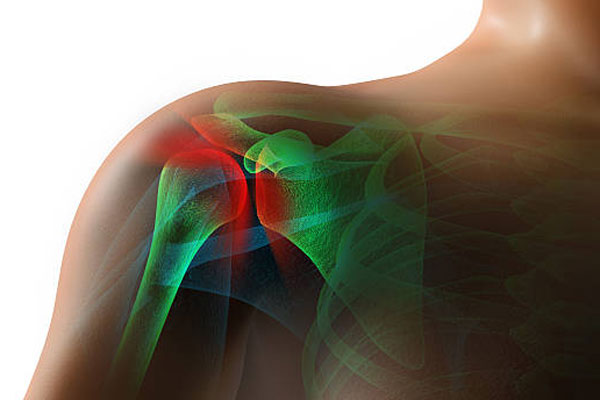 Rotator Cuff Injury