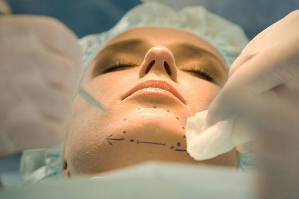 Osteotomy of the Chin